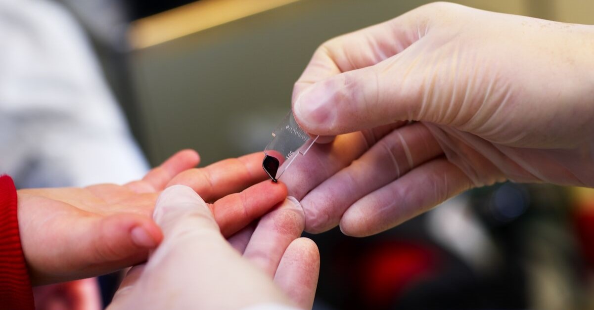 Capillary Sampling with a HemoCue Hb 201+ Microcuvette on a child's finger